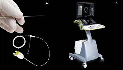 Experience with a novel high frequency optical coherence tomography device for intracoronary imaging: a case series